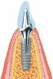 Sevenoaks Dentist